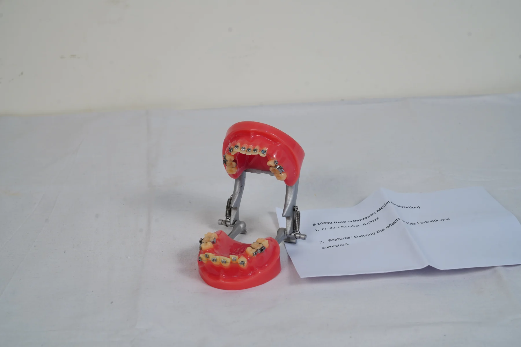 Fixed Orthodontic Model Dislocation thumbnail 2