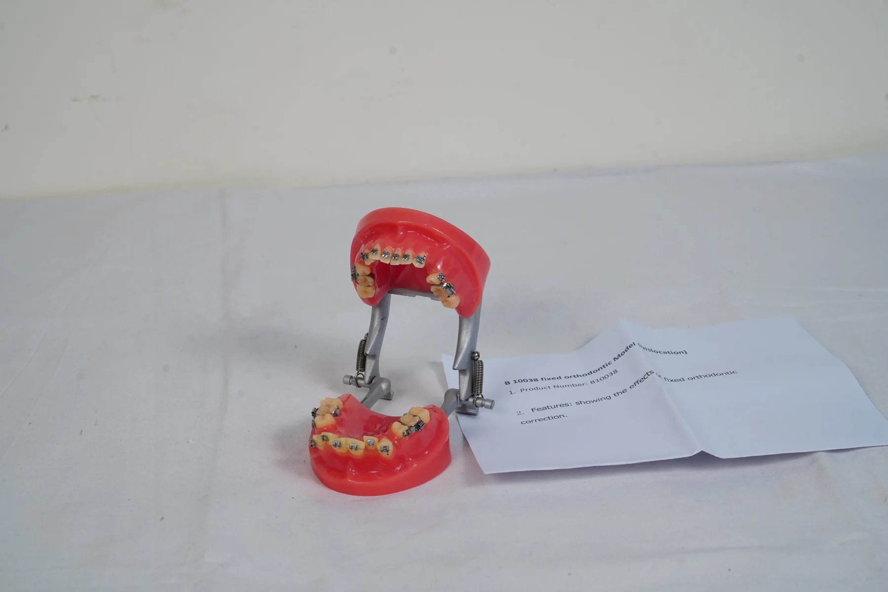 Fixed Orthodontic Model Dislocation thumbnail 3