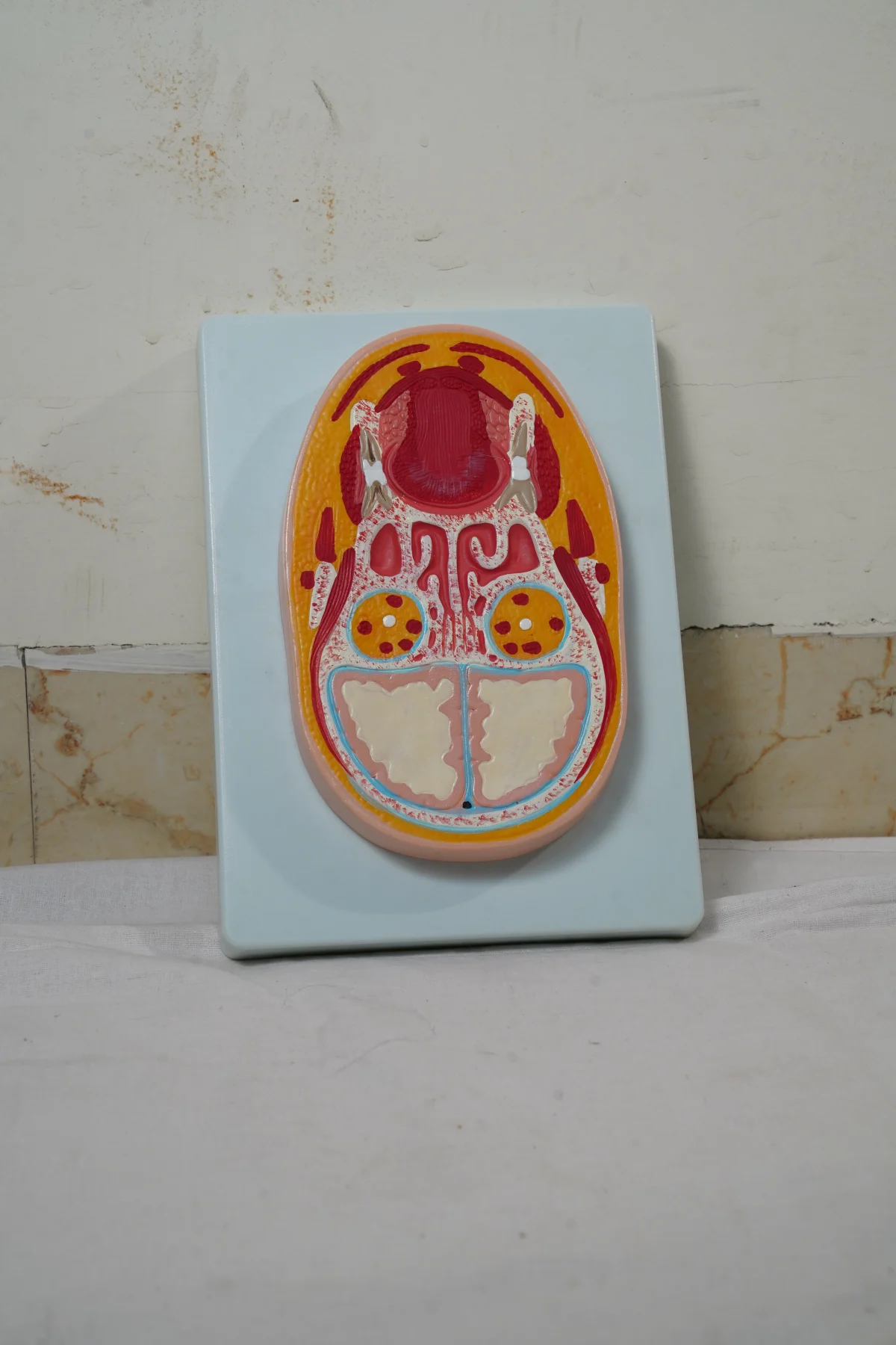 Frontal Section of The Head thumbnail 2