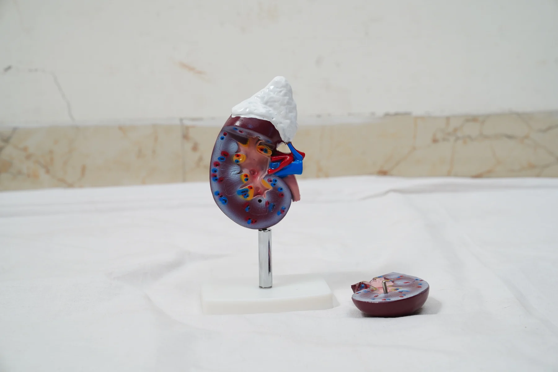 Human Kidney With Adrenal Gland thumbnail 6