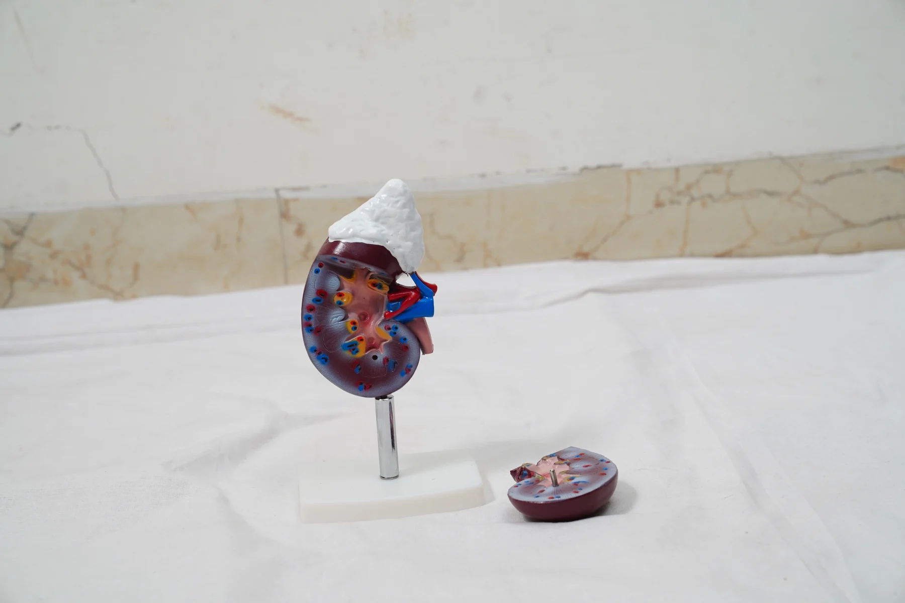 Human Kidney With Adrenal Gland thumbnail 2