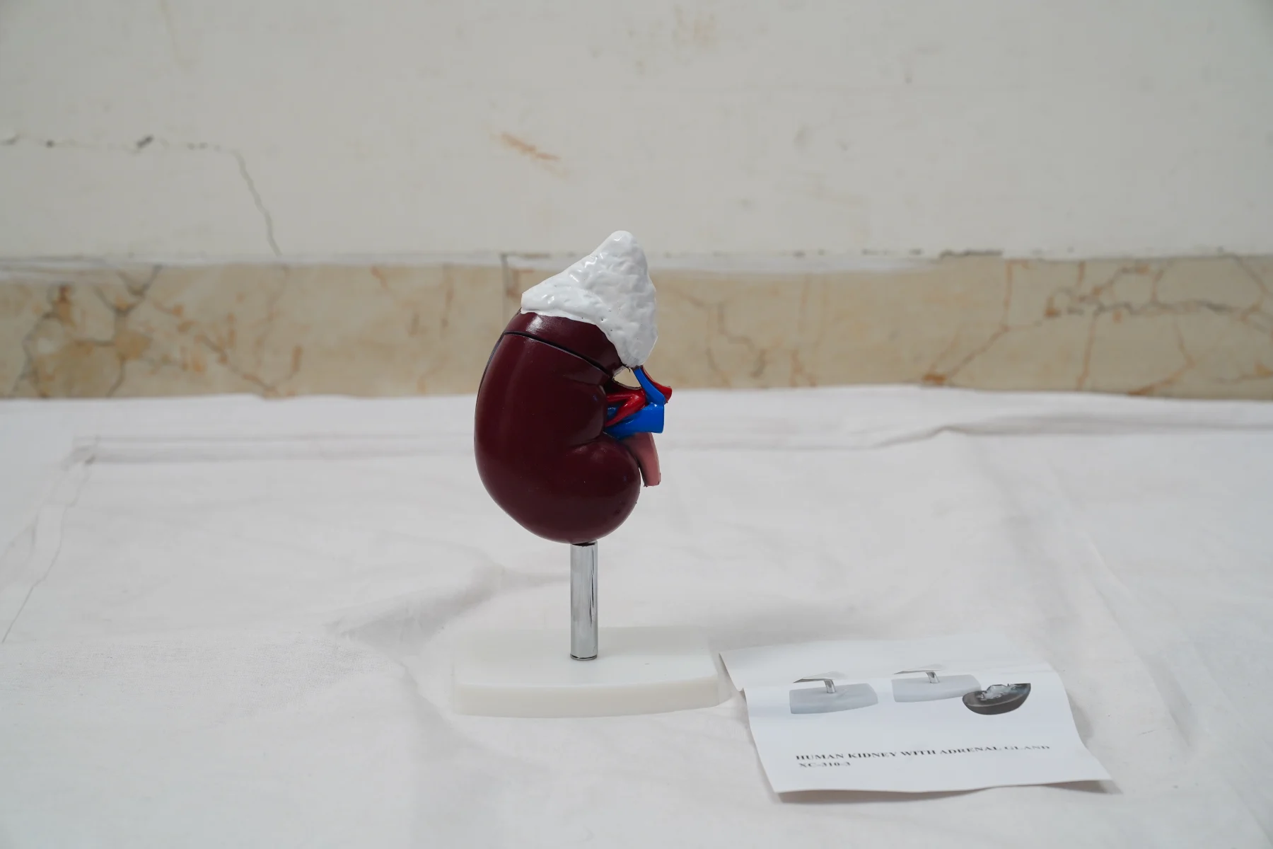 Human Kidney With Adrenal Gland thumbnail 5