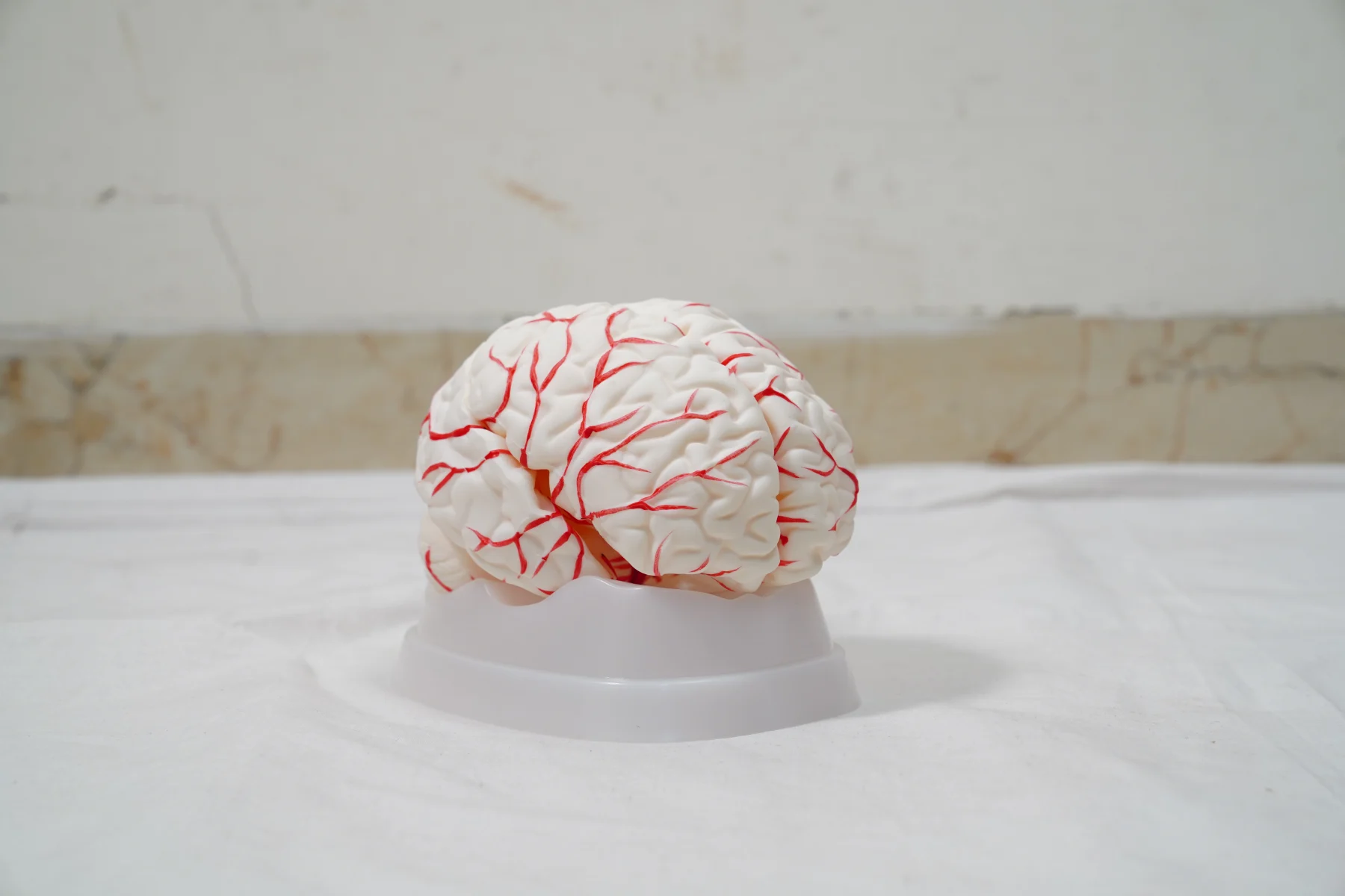 Brain With Arteries