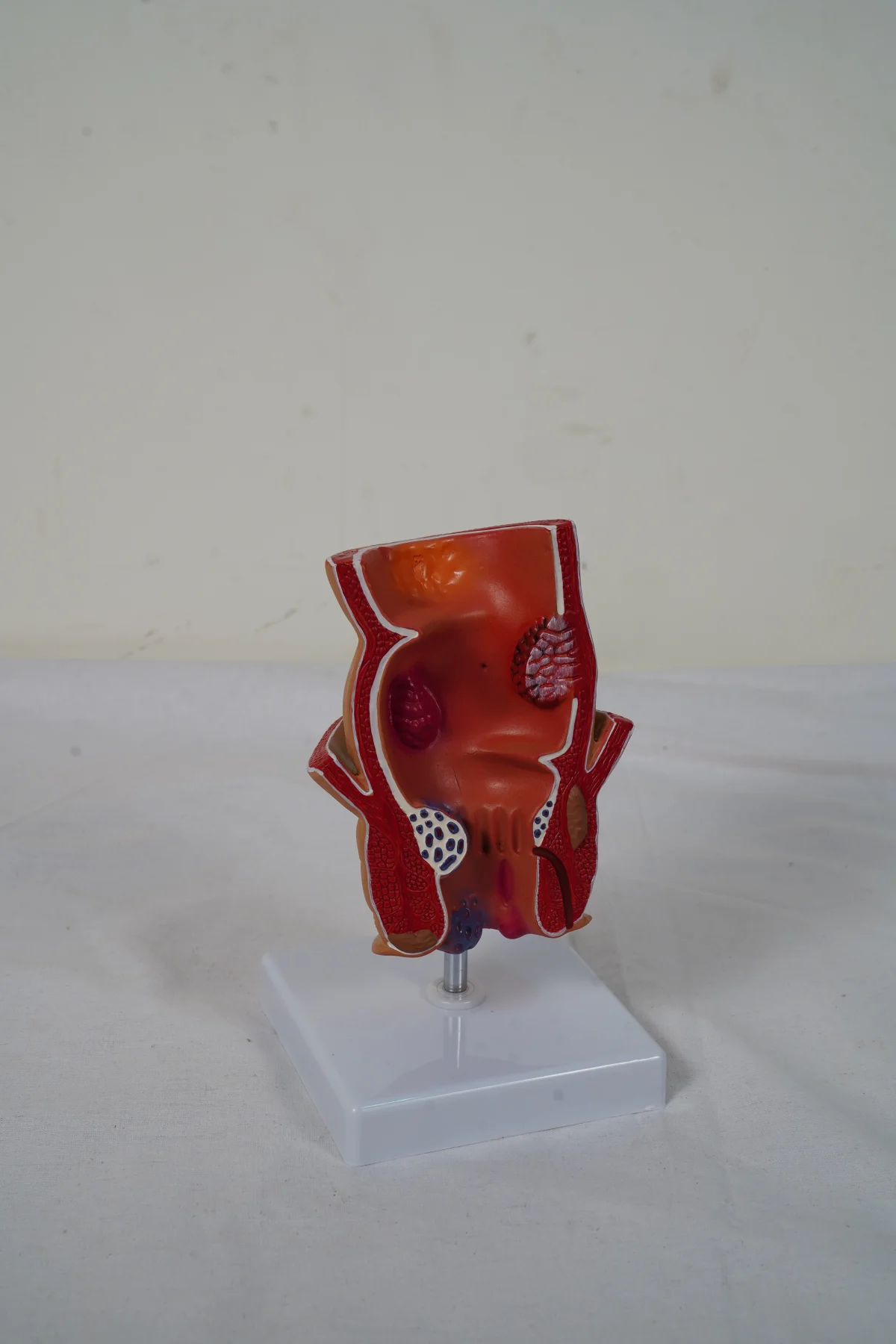 Rectum Model thumbnail 3