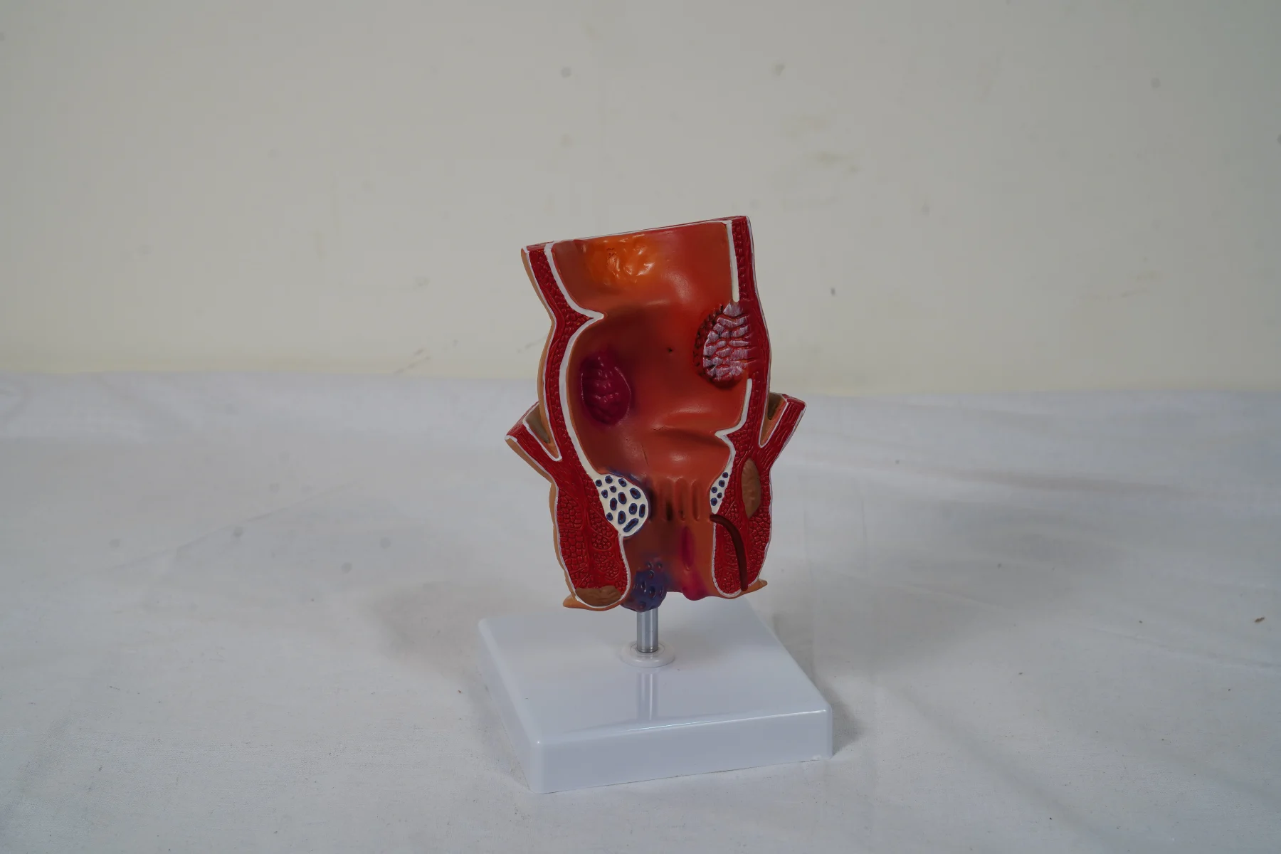 Rectum Model thumbnail 4