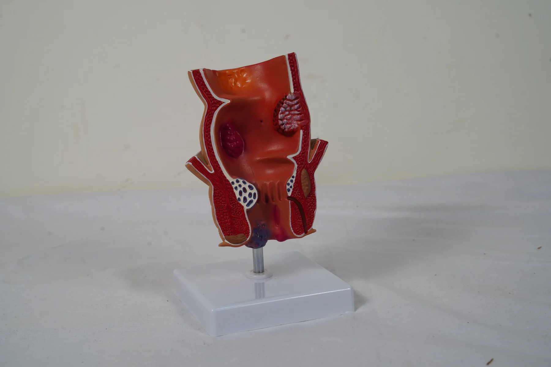 Rectum Model thumbnail 5