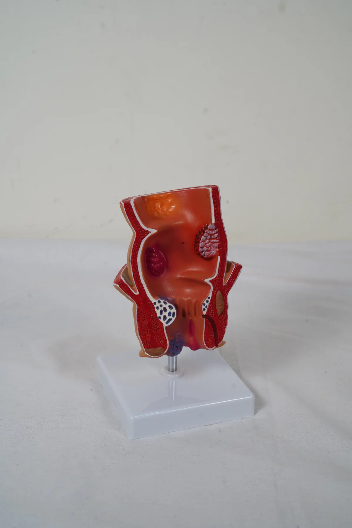 Rectum Model